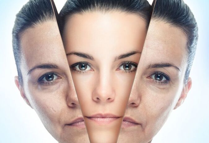 Proses menghapuskan kulit muka daripada perubahan berkaitan usia